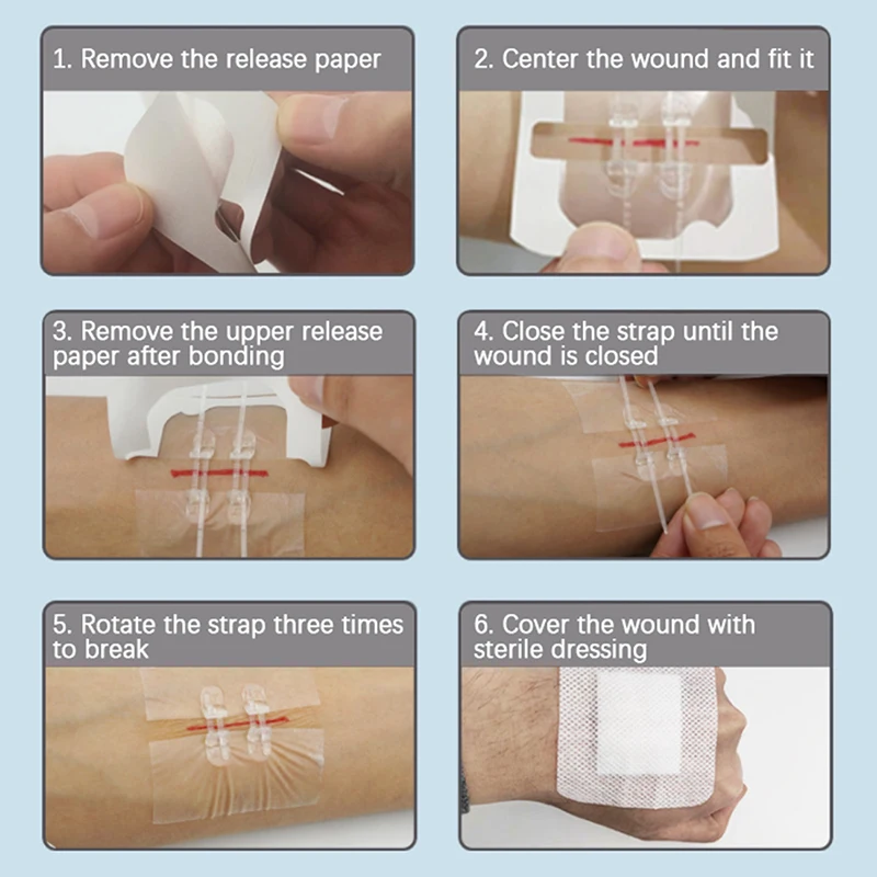 Bande arina de suture indolore pour la fermeture des plaies, patch d'aide aux plaies, soins hémostatiques rapides, accessoires de santé, équipement de camping