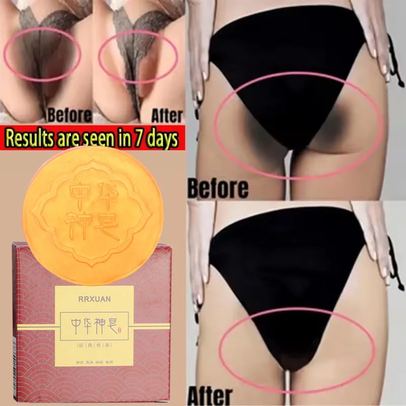 

Body Whitening Soap Deep Clean Skin Chicken Skin Removal Soap Armpit Underarm Knees Bleaching Body Brighten White Care Products