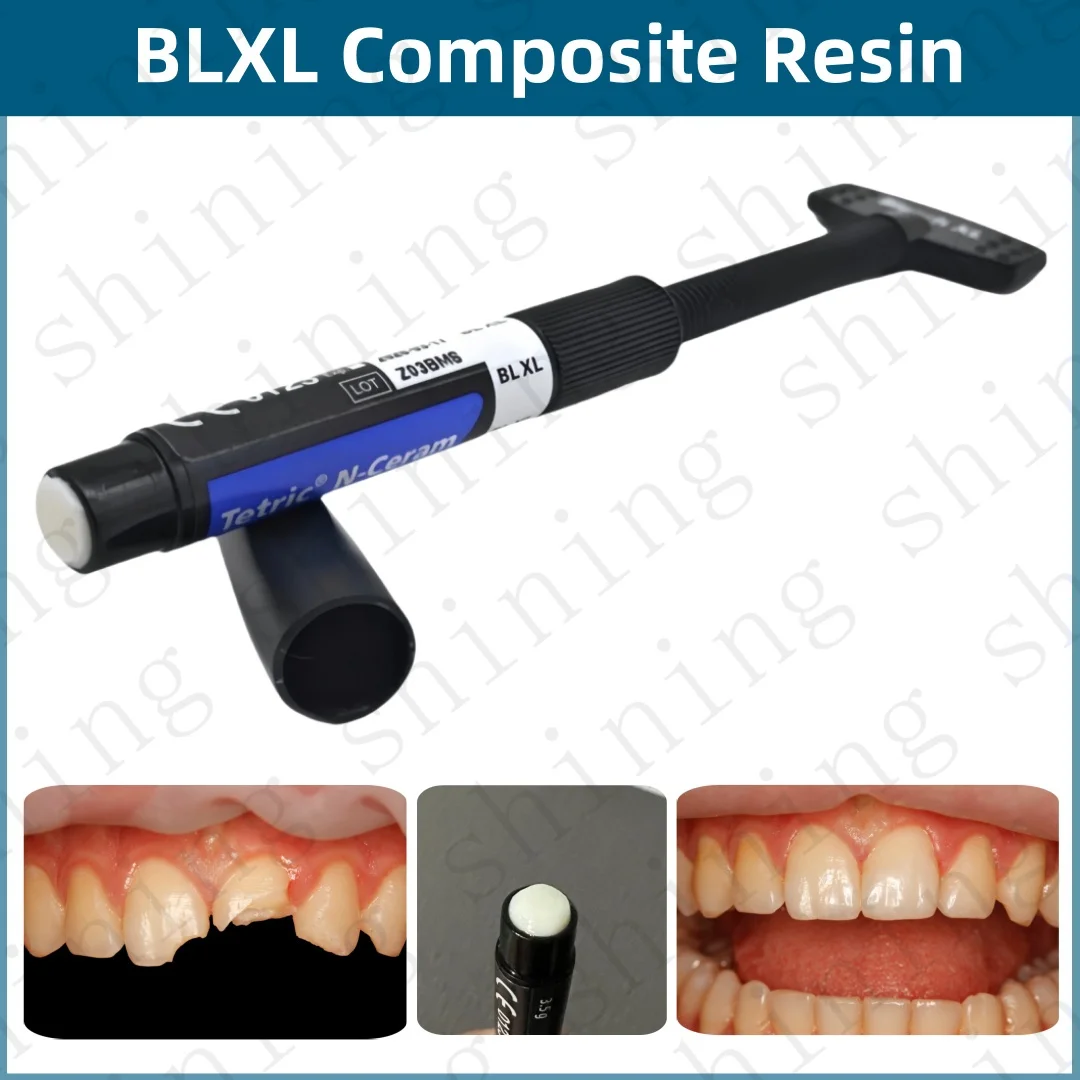 

BLXL Dental Tetric N-Ceram Composite Syringe Resin BL XL Bleach Color Whitening Veneer Light Cure Resin