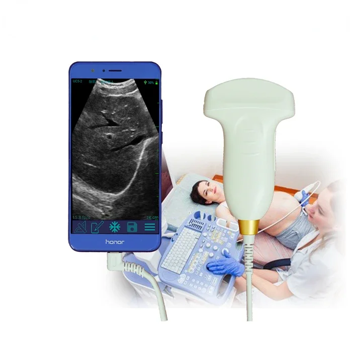 Digital ultrasound probe pocket machine ultrasound system