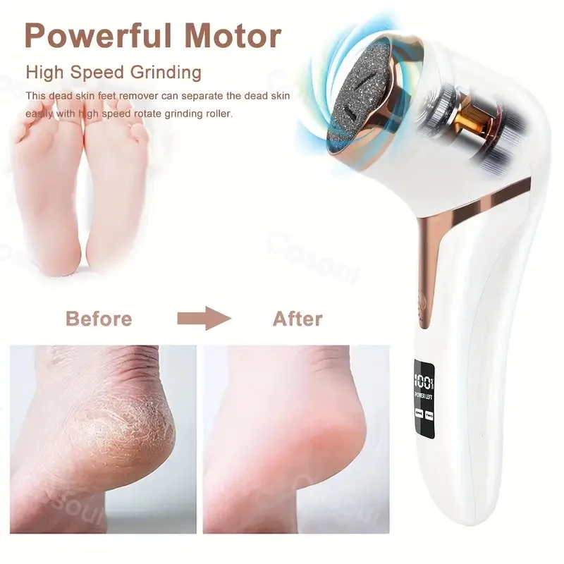 Professional Electric Callus Remover For Feet - Rechargeable Foot Care Kit With 3 Heads, Dander Vacuum Cleaner, LCD Display image 3