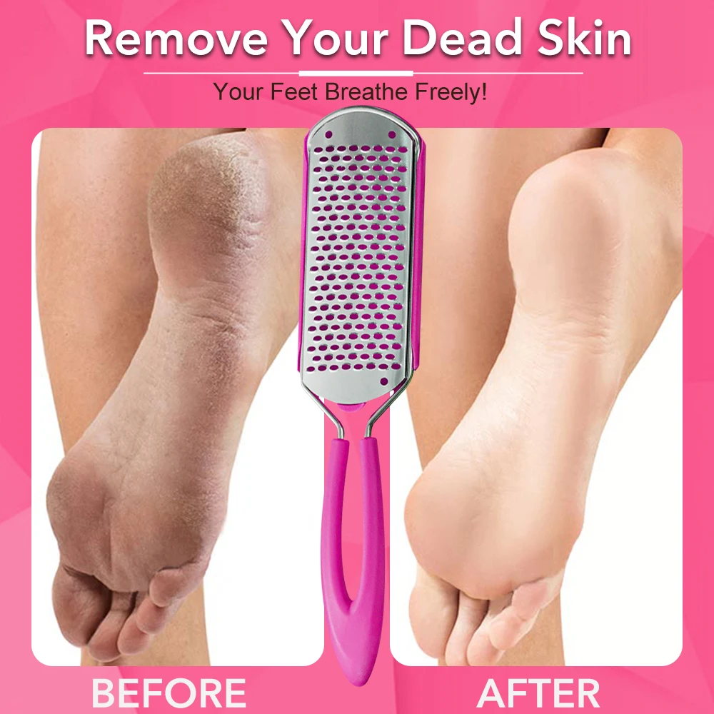 1 Stuks Rvs Voet Bestand Verkrachting Eelt Pellet Remover Harde Dode Huid Container Scrubber Voor Hak Verwijderen Pedicure spa Tool