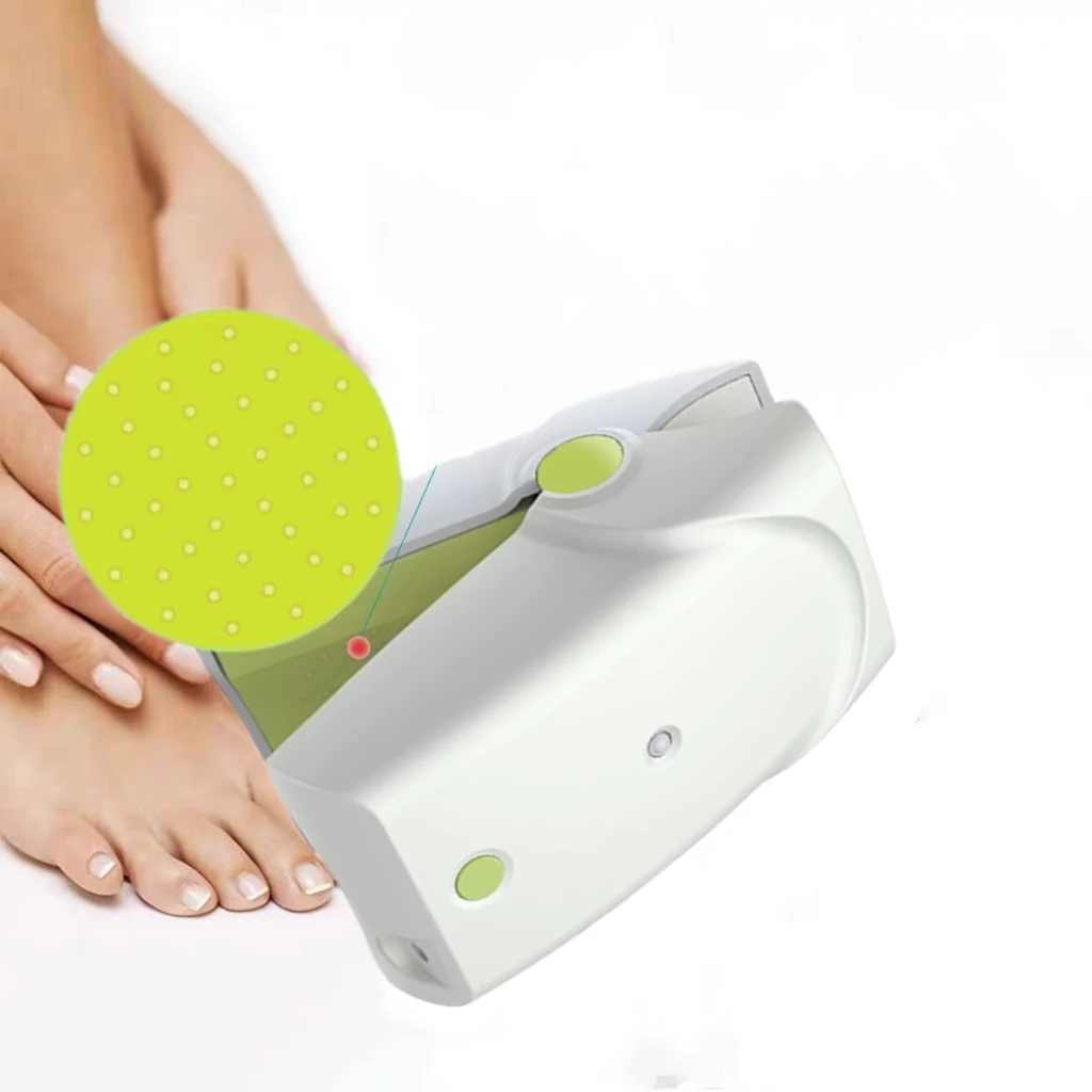 

Laser Device for Onychomycosis of the Foot Foot Care Removal Device
