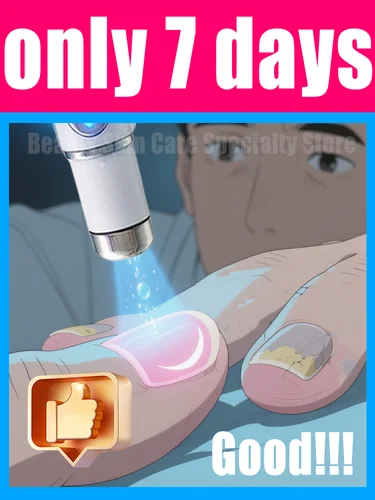 2025 vendedores calientes: herramientas de limpieza de uñas, herramientas láser de luz azul Reparación de raíces actualizadas a segunda generación