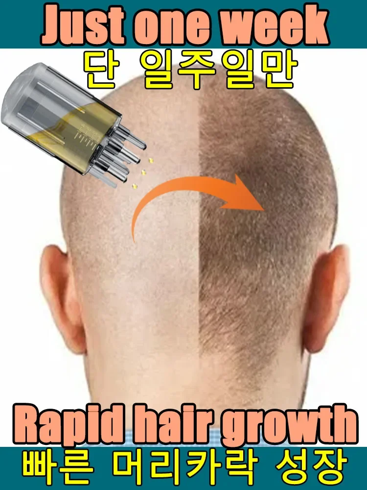 

100% revive cheveux, forteinaaétration, active les racines des cheveux, plus de cheveux, dit au revoir à la calvitie