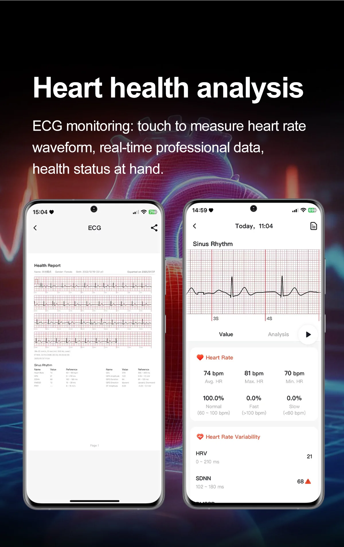 2026 Neue Körperfettanalyse Gesundheits-Smartwatch EKG+PPG Harnsäure Blutdruck Blutsauerstoff Uhr Anruf-Smartwatch für Männer Frauen – Detail 7