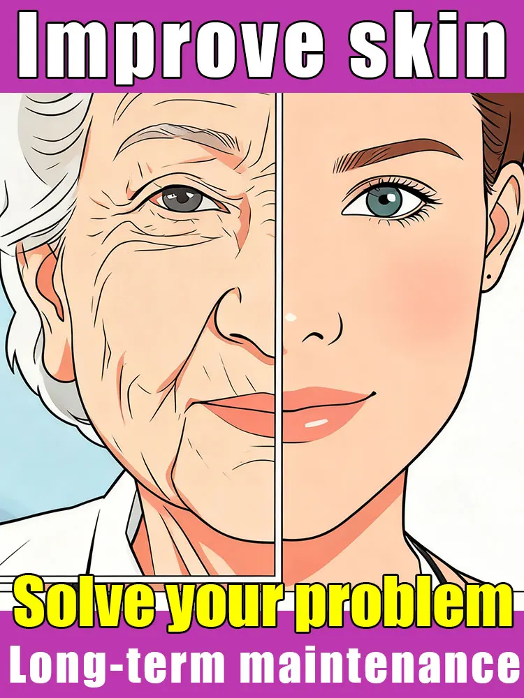 لا التجاعيد وليس الخطوط #1