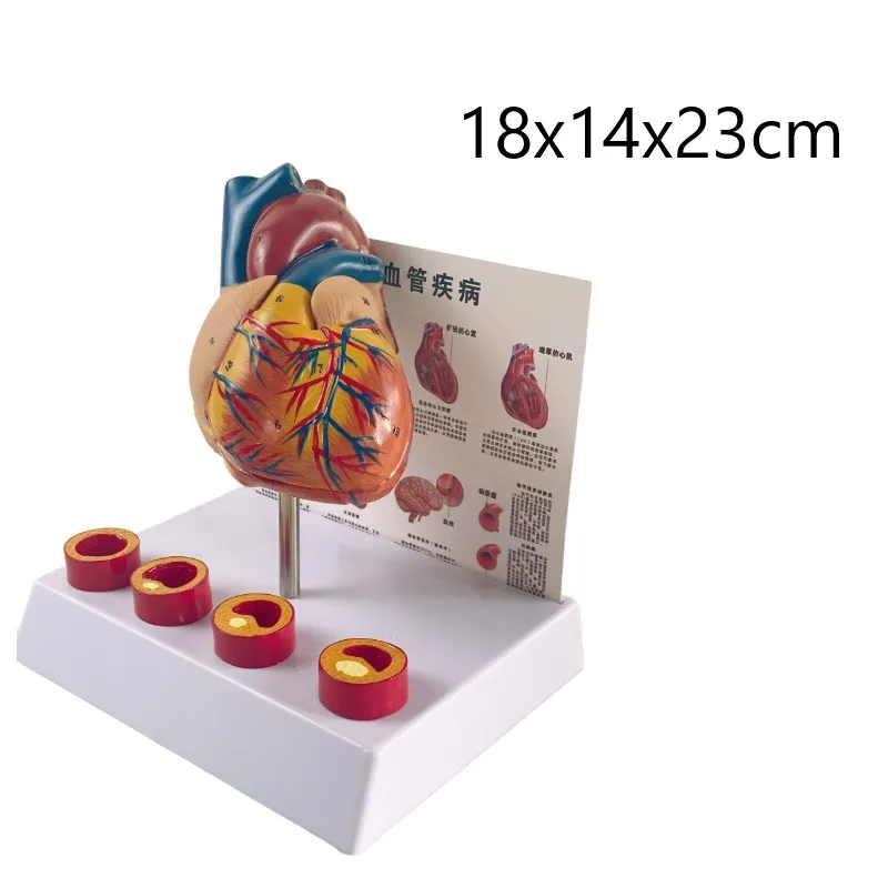 Removable Anatomical Human Life Size Heart Medical Cardiovascular Anatomy Thrombotic Vascular Model 18x14x23cm