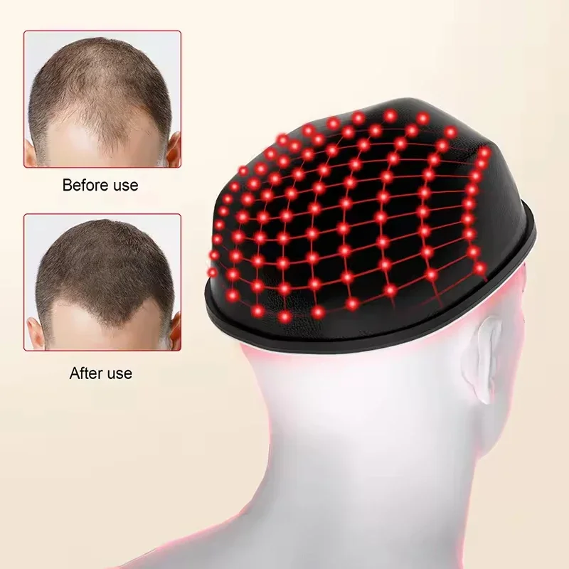 

2025 Safe And Comfortable Infrared Hair Growth Helmet for Anti Loss Promote Regrowth Therapy Scalp Care 650nm Laser