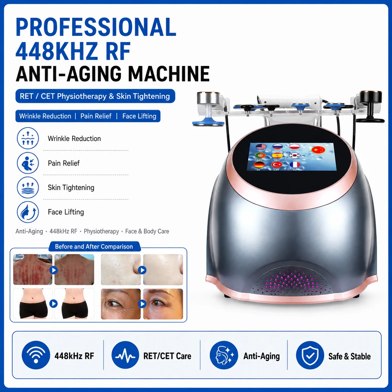 Professional 448kHz RF Tecar Physiotherapy Machine RET/CET JMD Pain Relief Muscle Recovery Joint Pain Treatment Clinic Home Use