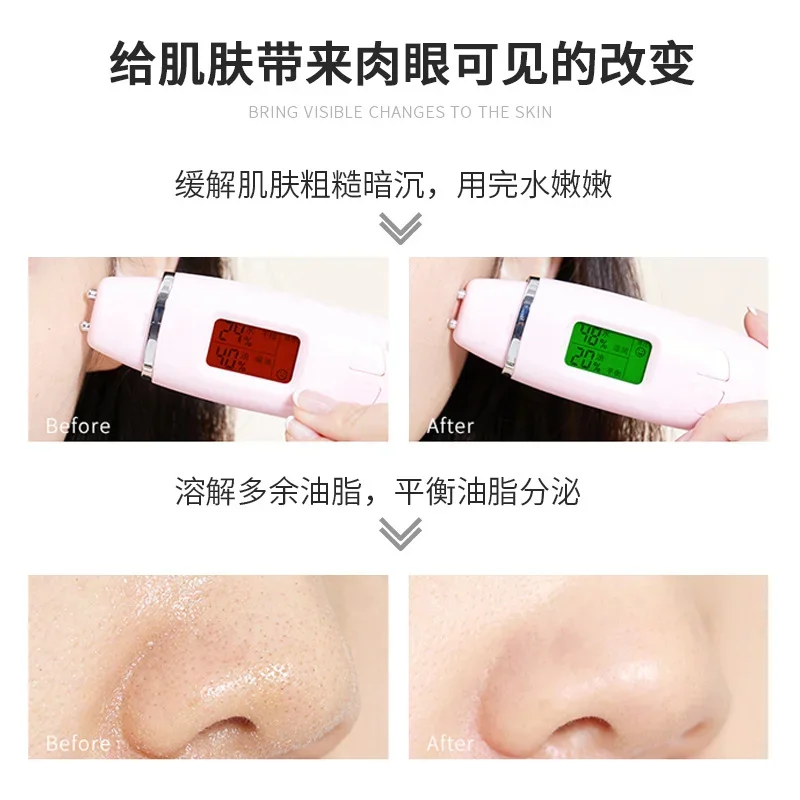 Glycolic Acid Peel 70% Skin Reshaping Repair Pores Invisible Brightens Complexion Acne Treatment Skin Care skin whitening beauty