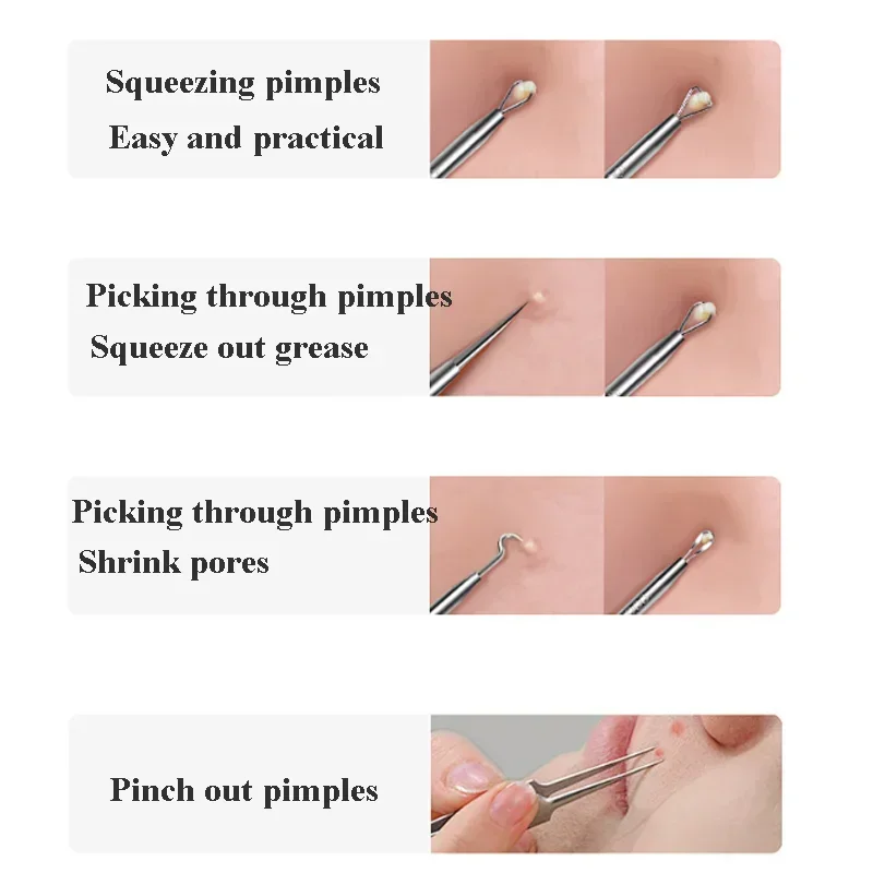 5-8Pcs Stainless Steel Acne Needles and Blackhead Removal Tools Pore Cleansing Tools for Professional Facial Skin Face Care Tool