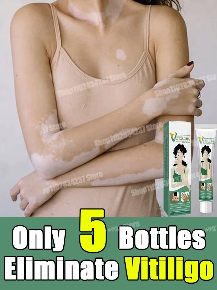 

Vitiligo Ointment Remove Ringworm White Spot Removal Skin Vitiligo Eliminate Vitiligo Cream