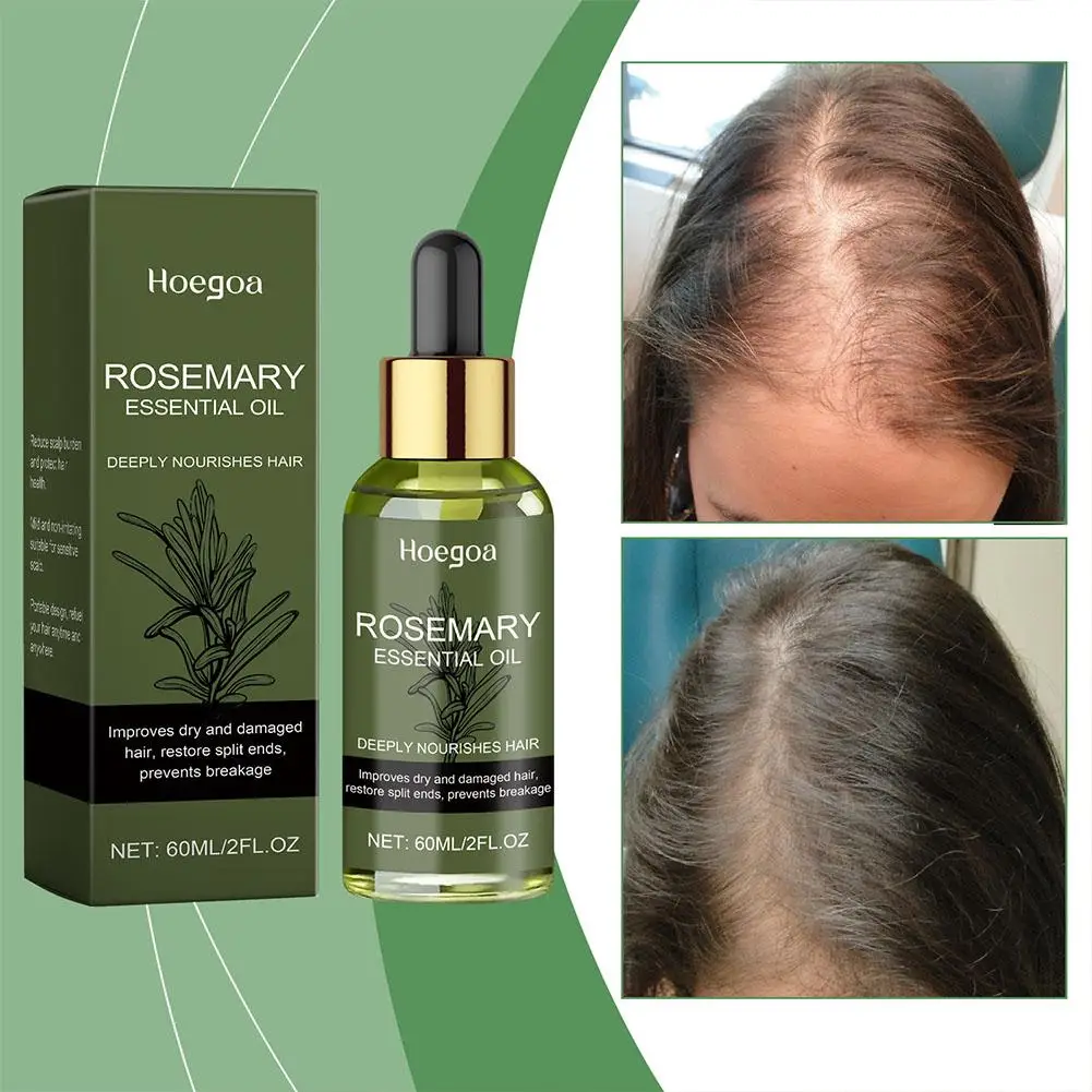 Huile essentielle de romarin pour le soin des cheveux, prévient la perte de cheveux, renforce et nourrit le cuir chevelu, traitement des cheveux secs et lisses