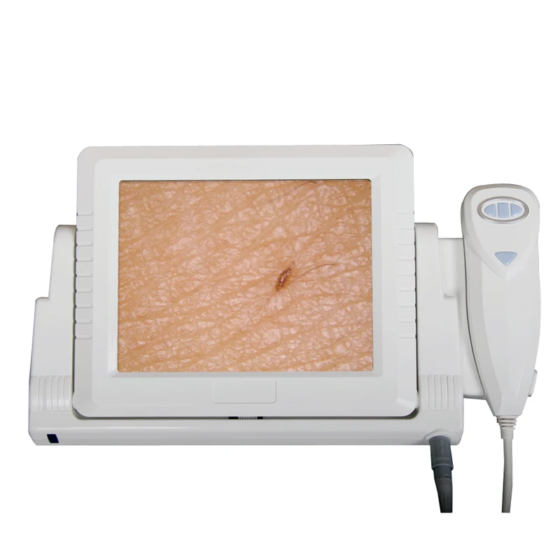 Home use portable 2MP hair skin analyzer machine