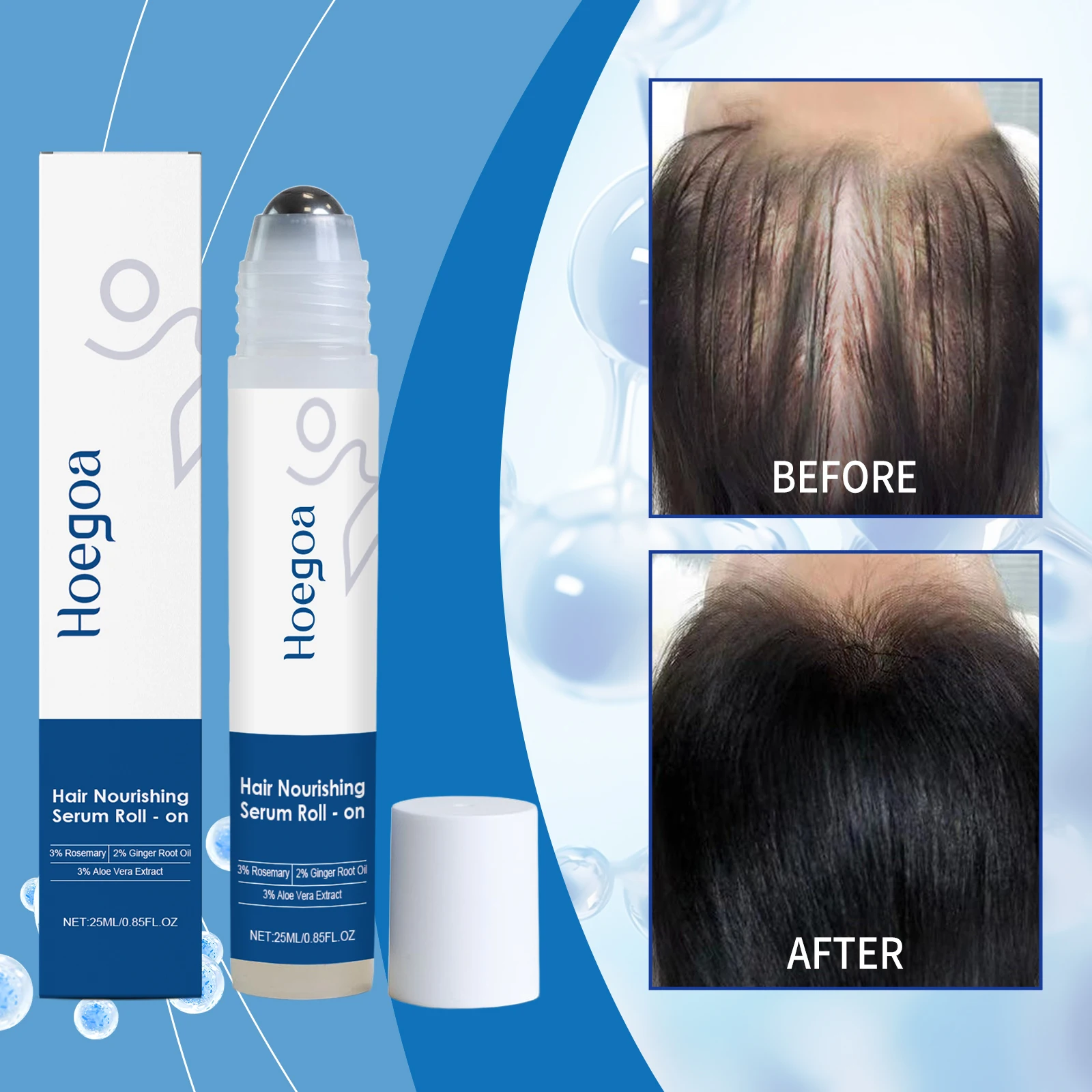 2026 latest technology new products Anti-hair Loss Essence Promotes Hair Growth and Improves The Scalp Environment