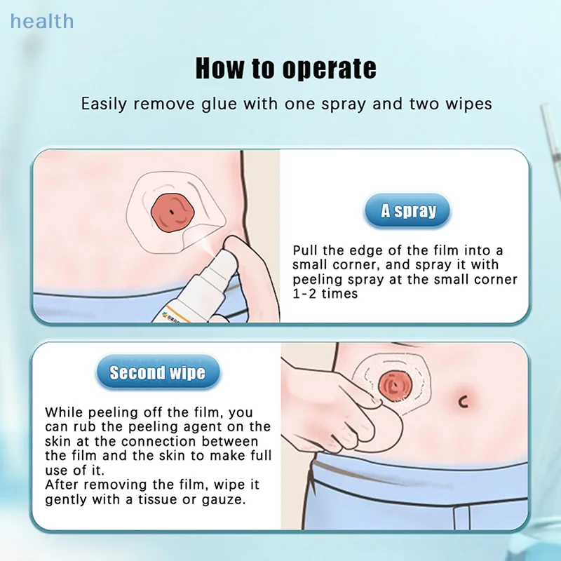 

Колостомический клей, протирающий спрей, медицинское средство для удаления клея, поставка колостомического мешка, защитные средства по уходу за кожей