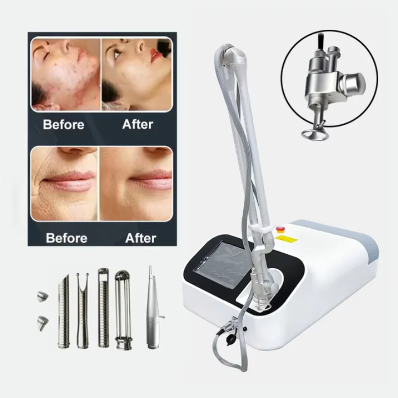 نظام ليزر ثاني أكسيد الكربون للإجراءات الشاملة لأمراض النساء والجلدية #1