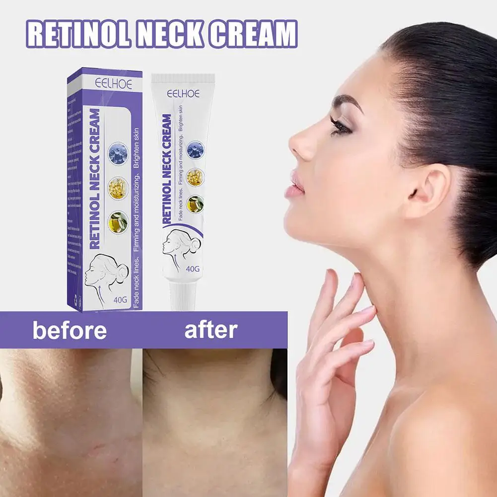 Retinol-Creme Removedor de Rugas, Anti-Envelhecimento, Facial, Pescoço, Clareamento da Pele, Hidratante, Nutritivo, Cuidado com Formas, 40g