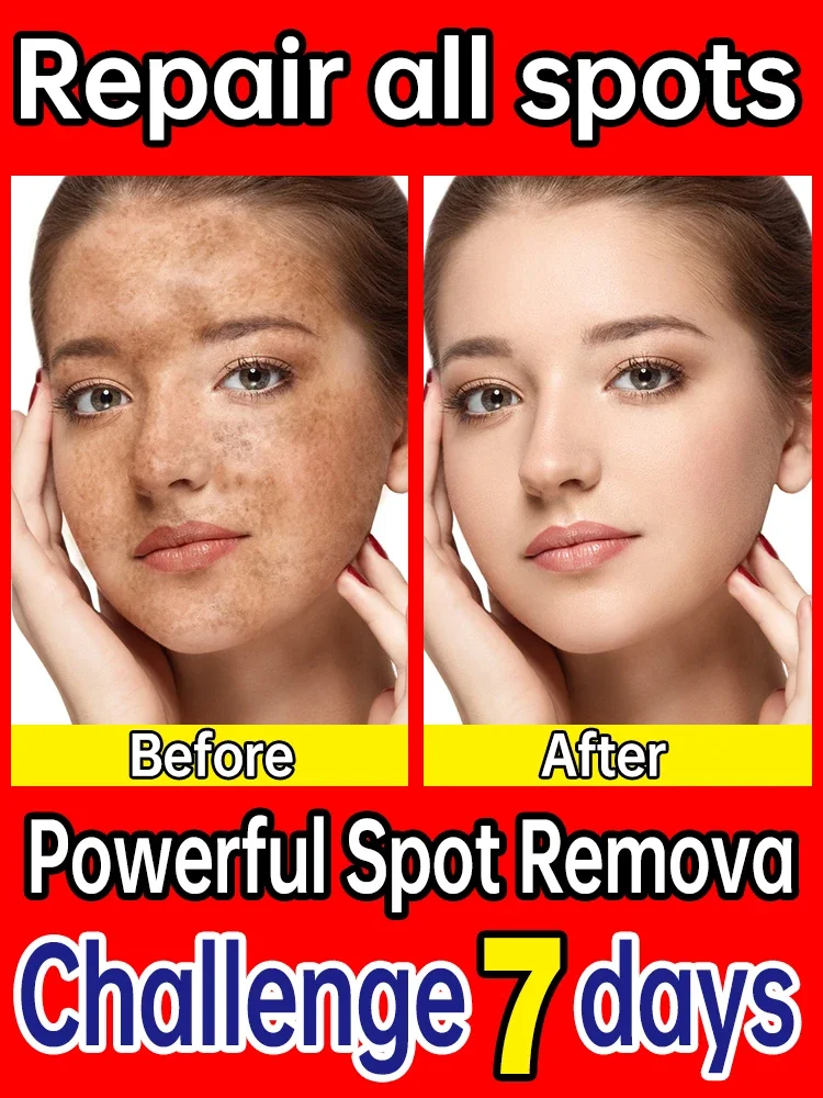 Facial Essence removal dark spot correcting