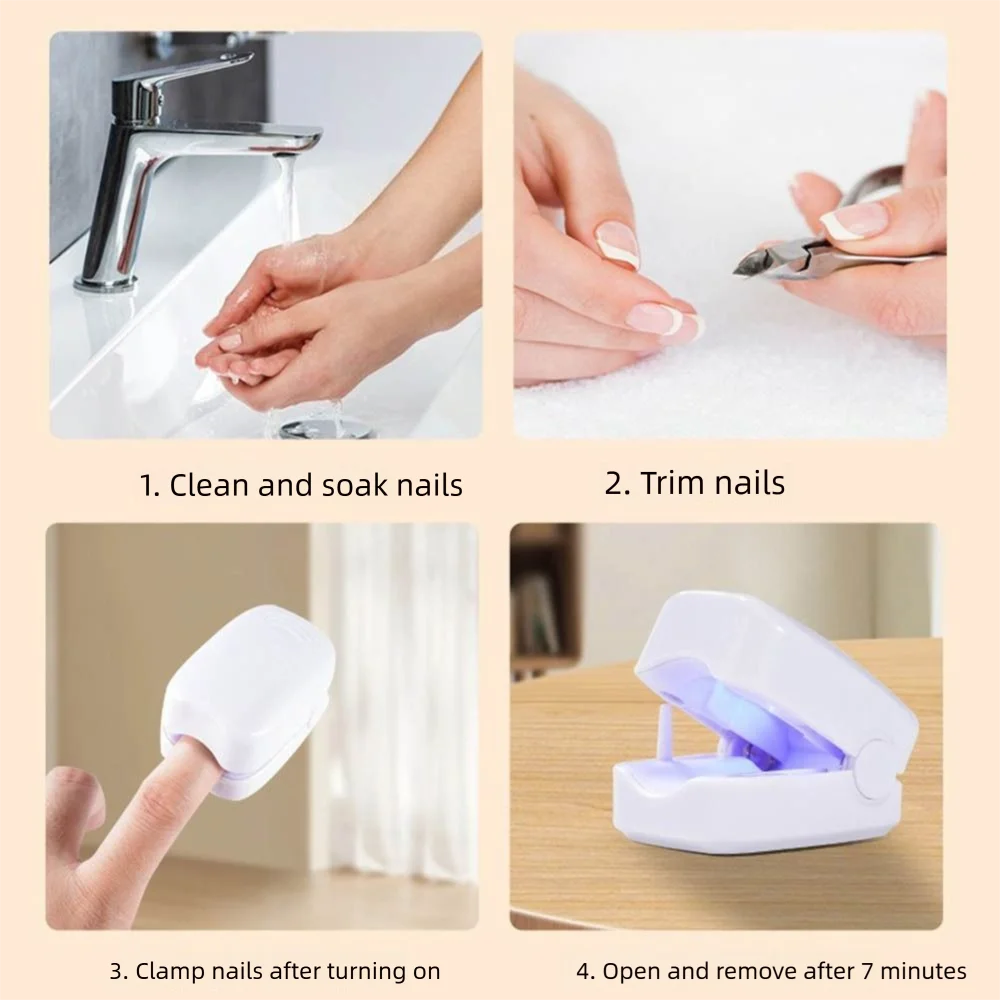 Effectieve nagelschimmel Remedie Snelwerkende USB oplaadbare nagelschimmellaserapparaat UV-desinfectie Handig