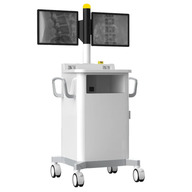C-arm X-ray digital machine, X-ray equipment, 5kw mobile high-frequency fluoroscopy, multifunctional digital surgery