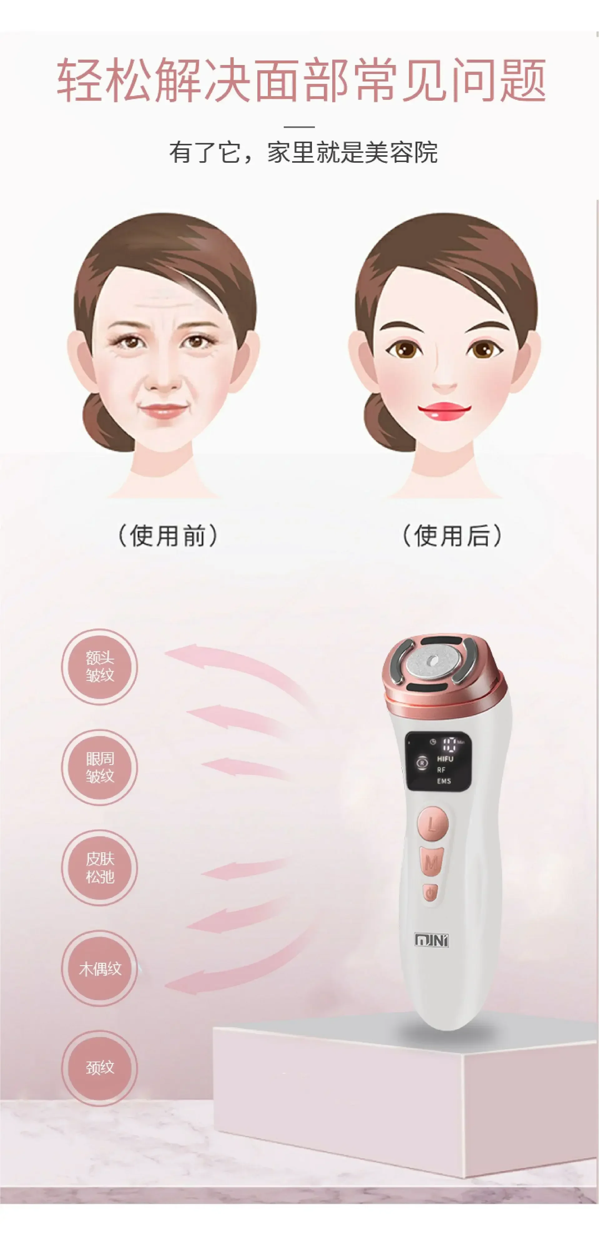 RF Radiofrequency Introducer HIFU Mini Ultherapy EMS Lifting Firming  Skin Rejuvenating Radiofrequency Instrument