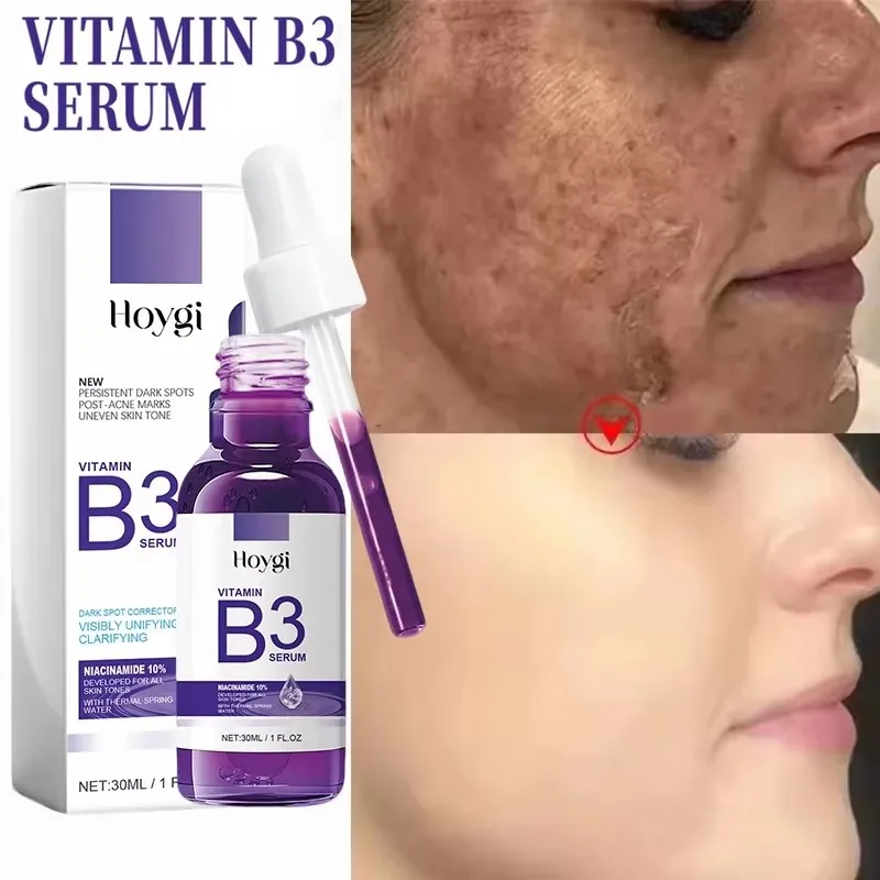 

Vitamin B3 Serum Fade Dark Spot Chloasma Lighten Melanin Pigmentation Smooth Pores Rejuvenation Brightening Moisturizing Essence