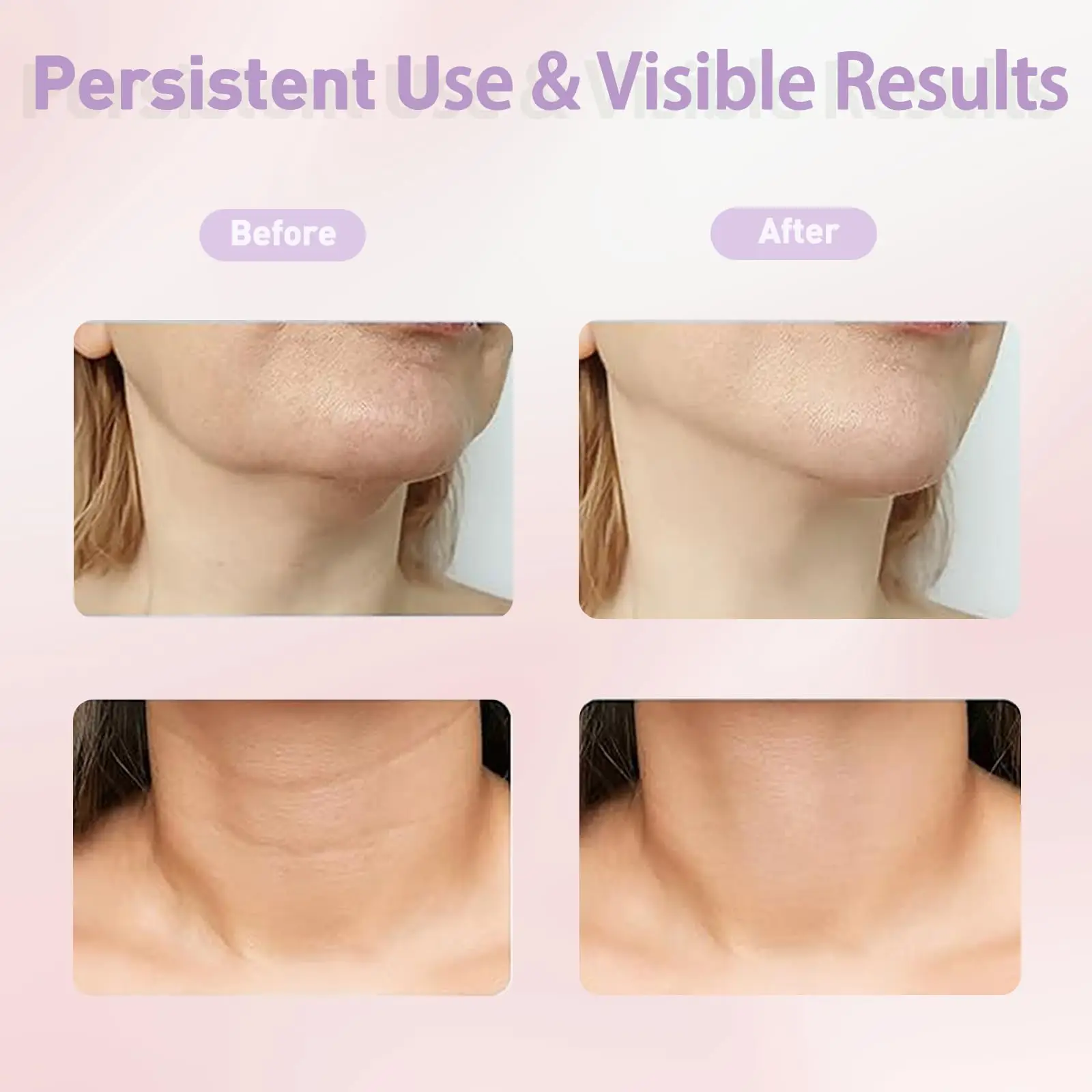 EMS Collo Face Lifter Collo Face Lifting Massaggiatore Dispositivo per stringere la pelle Led Photon Therapy Antirughe Doppio mento di rimozione