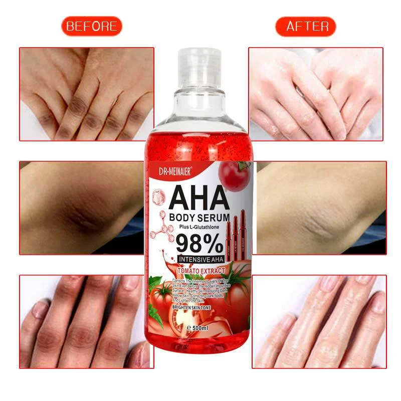 

500ML Tomato Essence for Women Skin Care Facial Body Whitening Moisturizing, Promote Skin Color Even Bright, Inhibit Melanin