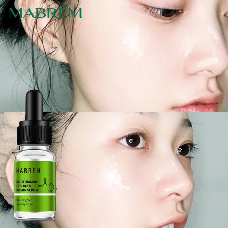 MABREM Nicotinamide Collagen Repair Solution Serum Whitening  Oil control Acne Delicate skin Facial serum Skin care  face care