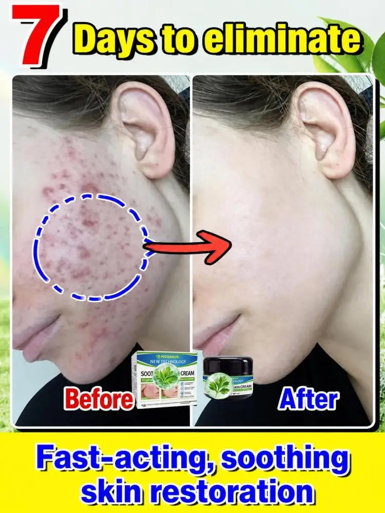 Comforting Soothing Facial Moisturizer Cream, Support Skin Barrier Health, Gentle Hydrating Nourishment, Calm Discomfort‑Prone Skin, Soft Daily Face Lotion for Men Women Home Skincare Routine