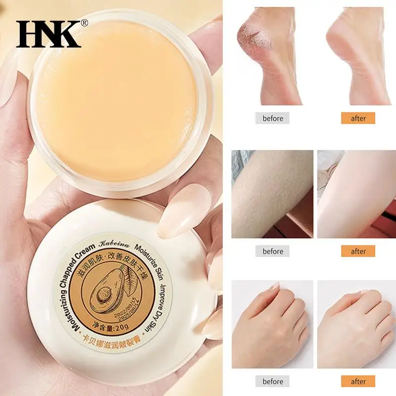 

Herbal Anti Cracked Heel Treatment Cream Hand Foot Moisturizing Repair Anti-Drying Removal Callus Dead Skin Balm Skin Care Mask