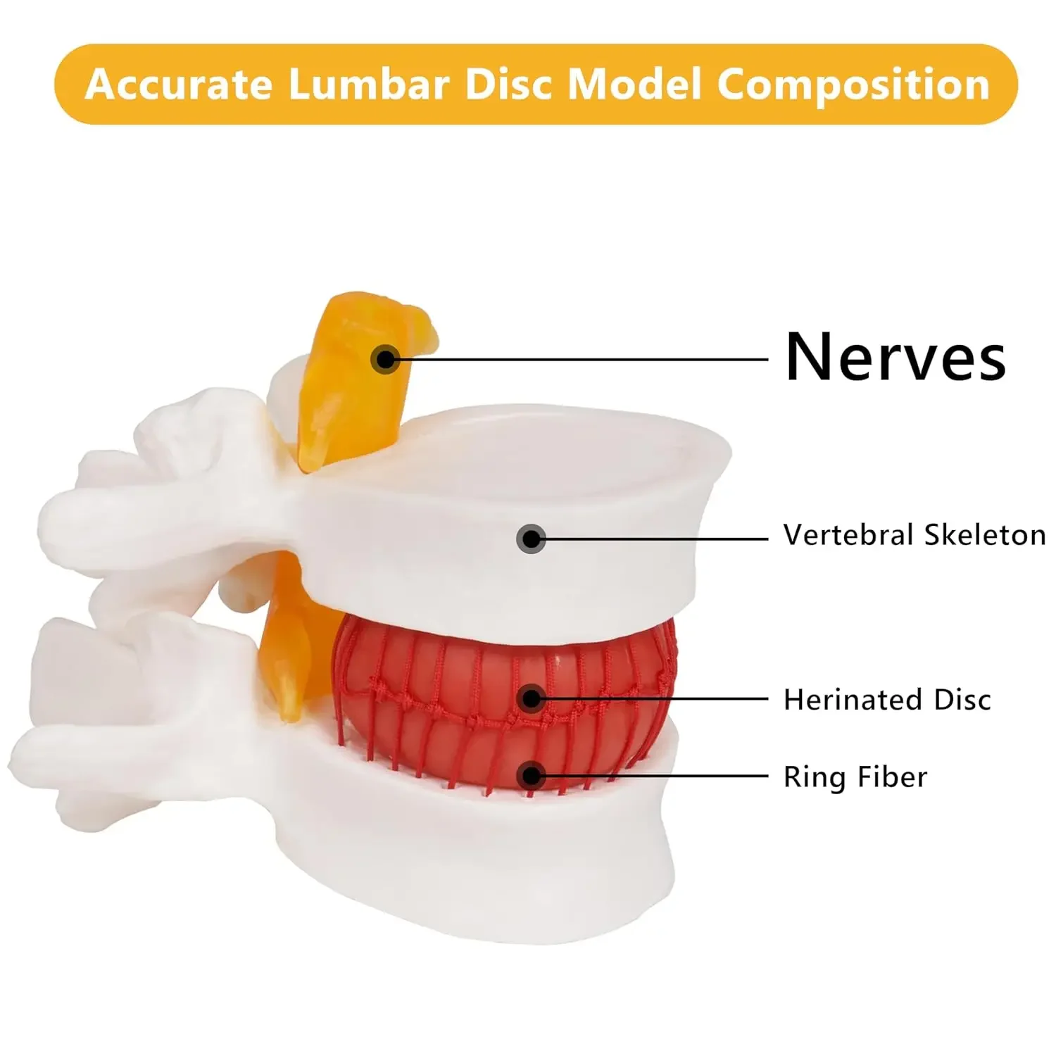 

1.5X Human Anatomical Lumbar Disc Herniation Model, Movable Human Lumbar Disc Herniation Model Teach Demonstrating Tool