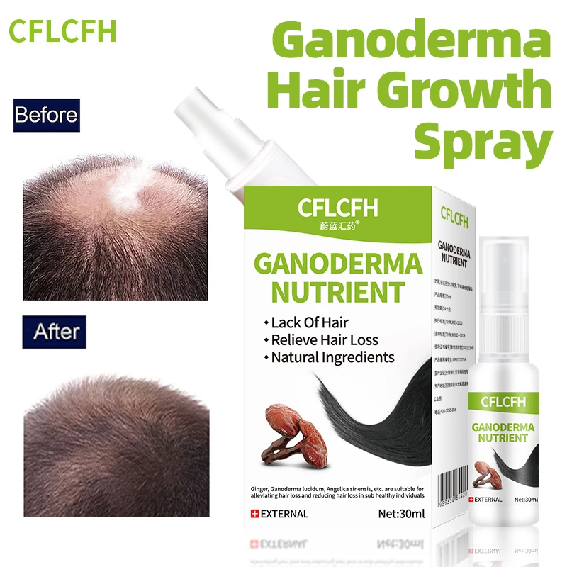 

Hair Growth Spray Anti Hair Loss Treatment for Men Women Ganoderma Lucidum Ginger Liquid Scalp Hair Care Fast Regrowth Products