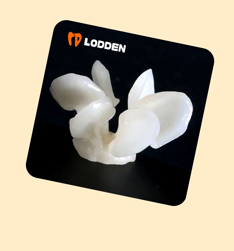 LODDEN Dental-Pressingots Glaskeramik HT/LT Dental-Veneer Lithiumdisilikat 10 Stück Zahnmedizinische Labormaterialien – Detail 11