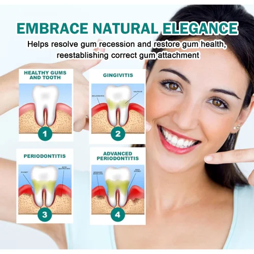 Imagen 2 del producto Suero de reparación rápida de encías, alivia eficazmente la alergia dental, caries, limpieza dental, pasta de dientes, alivia las gotas de daños en los dientes