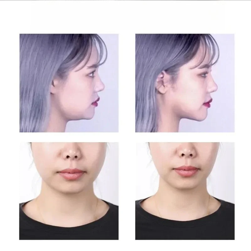 40pcs Invisible Thin Face Stickers Fast Face Lift Up Facial Line Wrinkle Sagging Skin V-Shape Chin Adhesive Tape - Detail 1