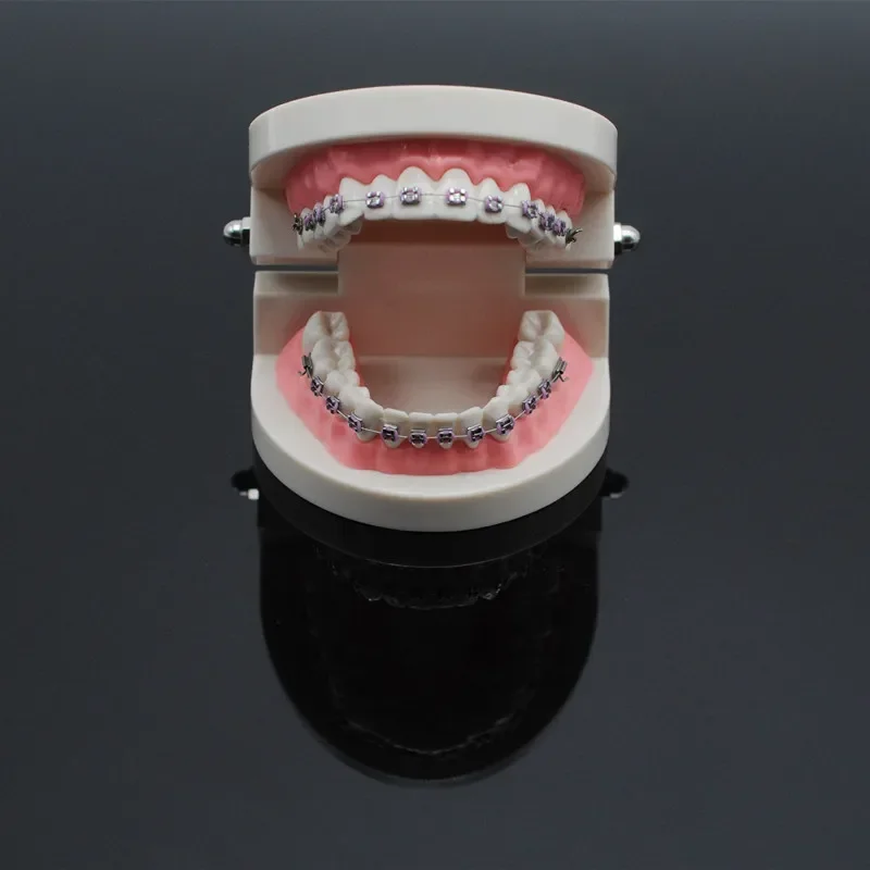 치과 교정 치료 모델, 교정 금속 브래킷, 아치 와이어 협측 튜브 결찰 타이, 치과 도구, 1 개