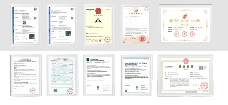 Видеоларингоскоп высокой четкости с большим экраном полного вида и многоразовыми лезвиями