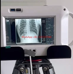 Medical Handheld X-Ray Machine Portable Vet X-Ray Radiography System  Touch Screen Handheld X-ray Machine