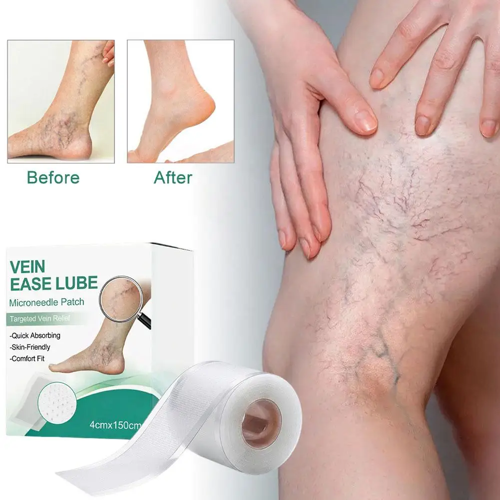 

Vein Target Microneedle Patch Eliminates Varicose Veins Improves Blood Circulation for Earthworm Legs Treatment Enhance Veins