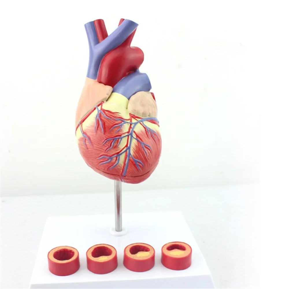 Life Size Human Heart Anatomy Model With 4 Stage Vascular Mounted on White Base Cardiac Learn