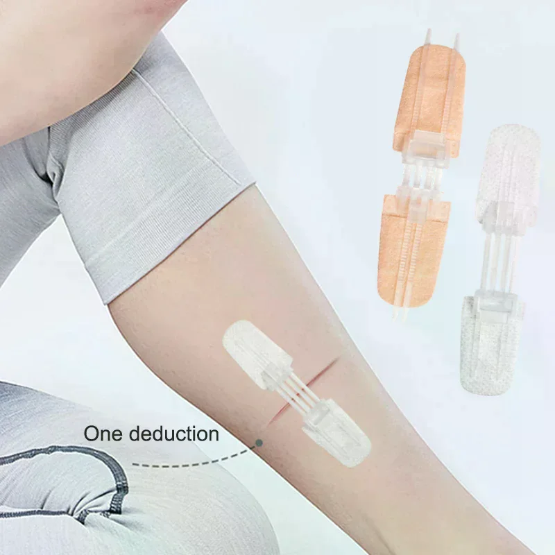 Zipper Band-aid Painless Wound Closure Patch Suture-free Wound Dressing Patches Zip Suture Reducer Band Aid Outdoor Portable