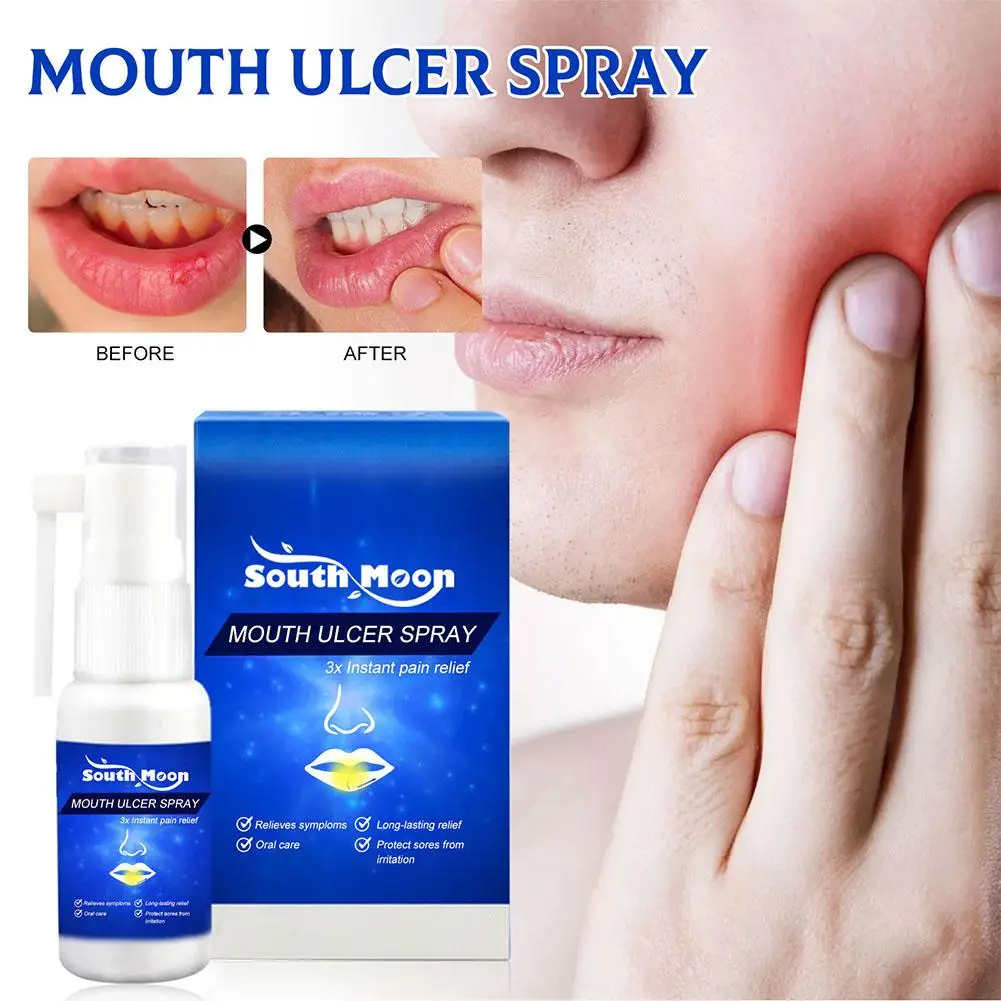 30ml Mouth Ulcer Spray Treatment Swollen Gums Oral Canker Sores Pain Relief Fresh Breath Antibacteria Halitosis Mouth Clean Care