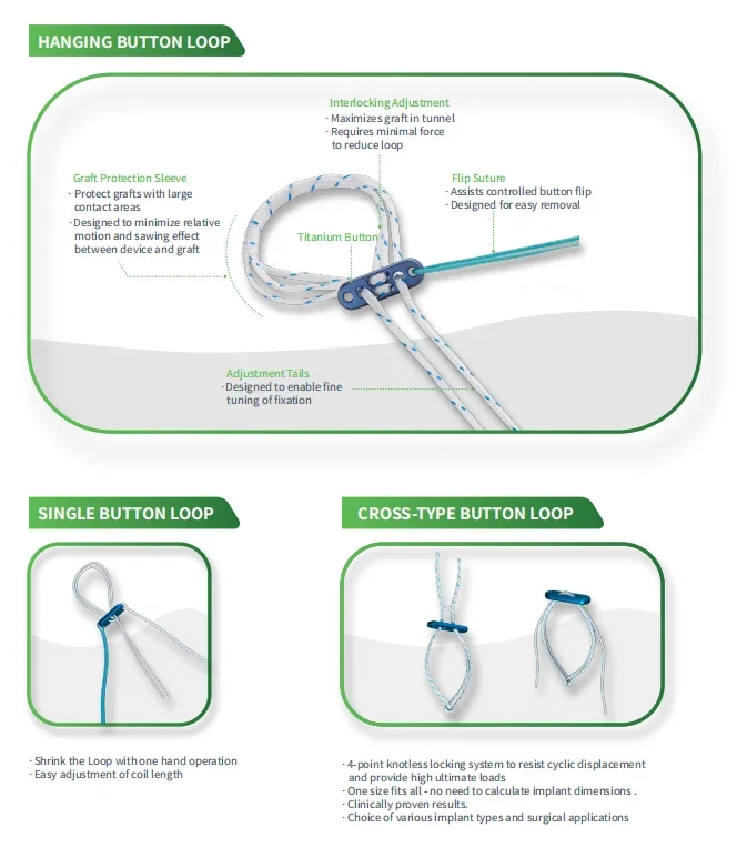 UND TECH Hohe Qualität für Knochensehnenknochen ACL Rekonstruktionsverfahren Knopfsystem