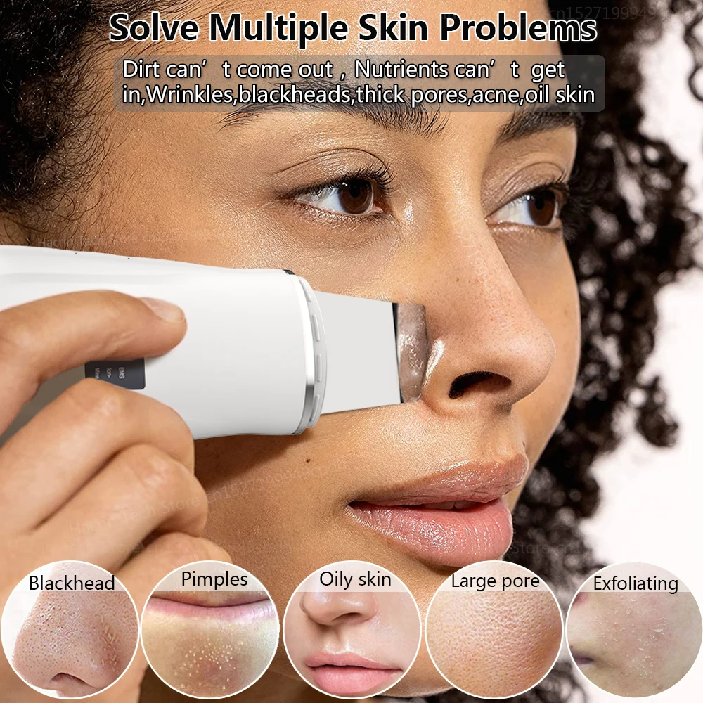 Purificador ultrassônico da pele, limpador facial ultrassônico, removedor de cravo, dispositivo de peeling ultrassônico para limpeza profunda do rosto