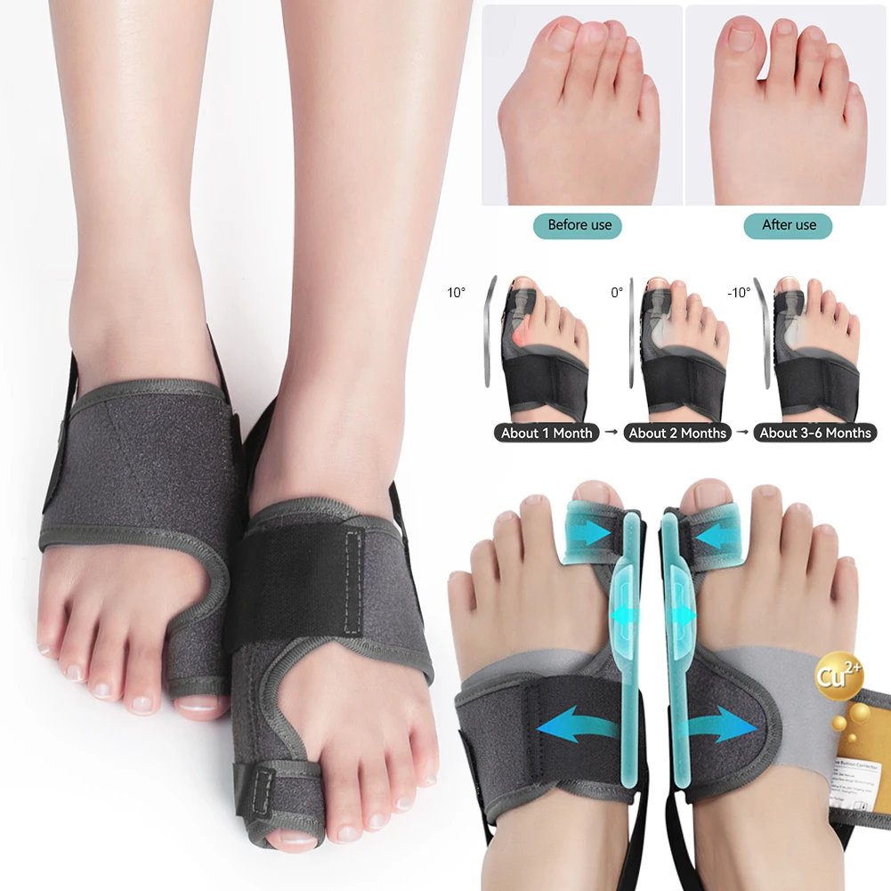 1 Pair Adjustable Bunion Corrector Bunion Fix Splint Corrector Big Toe Separator Pain Relief Correction Hammer Toe Straightener