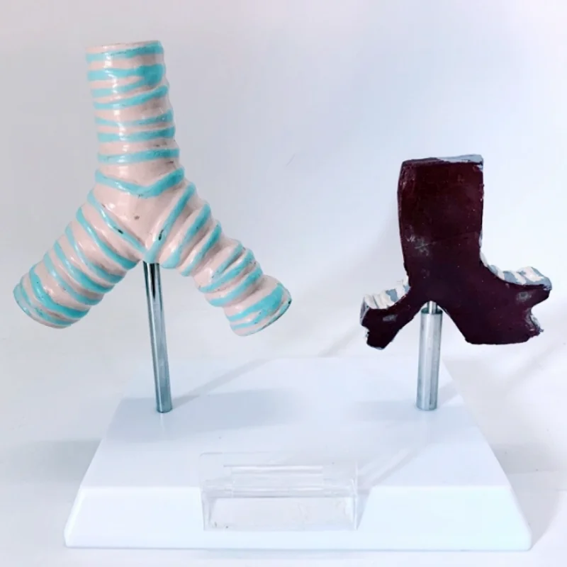 

Human smoking trachea and healthy trachea comparison model pathological tracheal anatomy model