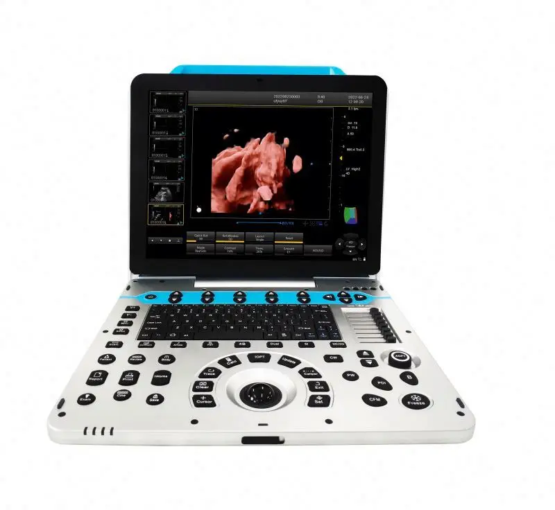 12.1 Inch 4D 3D Diagnostic Ultrasound Machine Color Doppler Ultrasound Machine